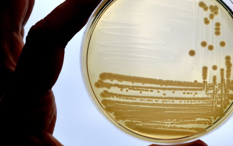 Lire la suite à propos de l’article Escherichia coli : ce qu’il faut savoir sur cette bactérie