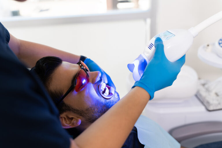 Lire la suite à propos de l’article Améliorez votre sourire : découvrez les secrets du blanchiment dentaire